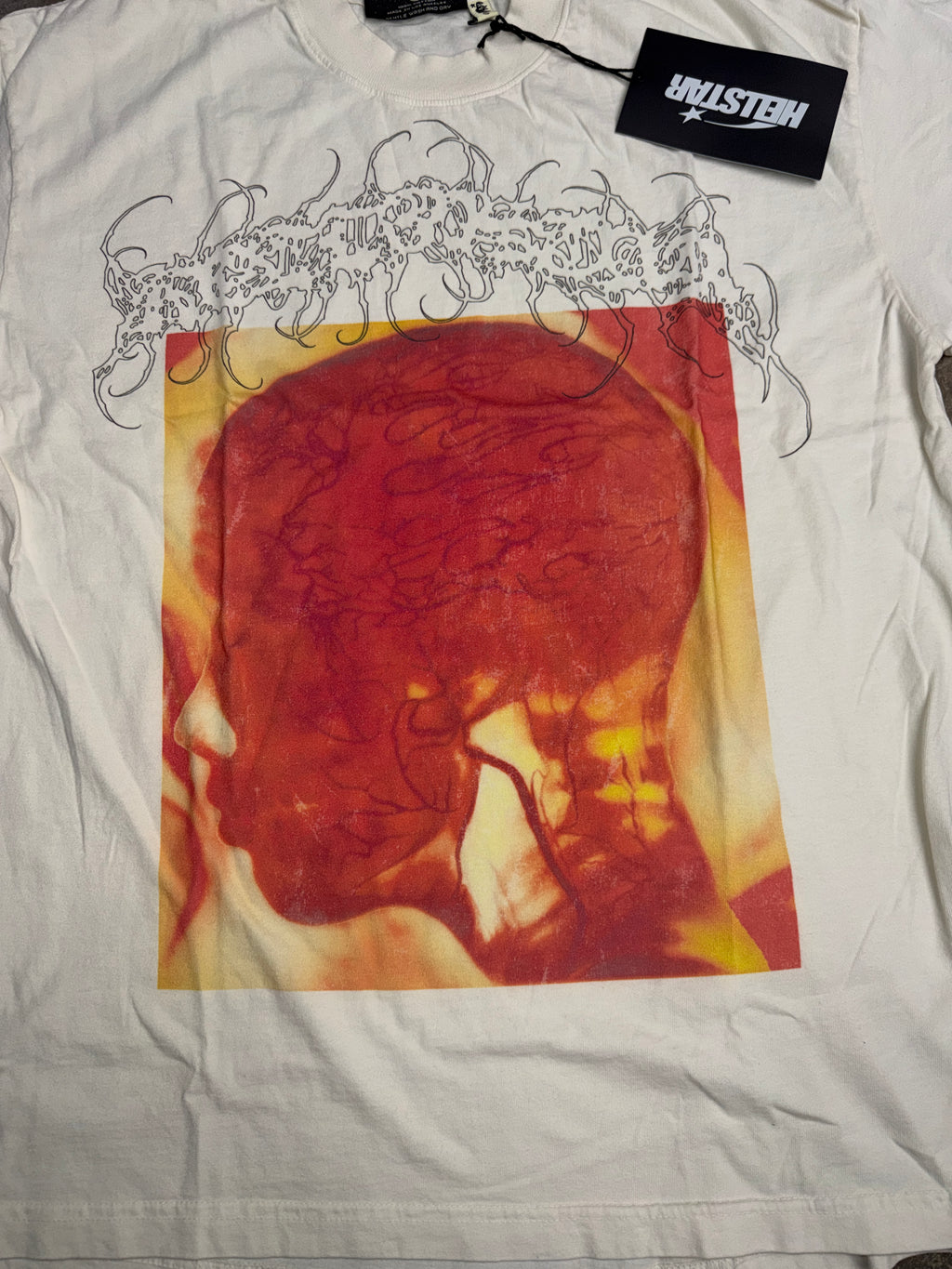 HS X-ray T-shirt